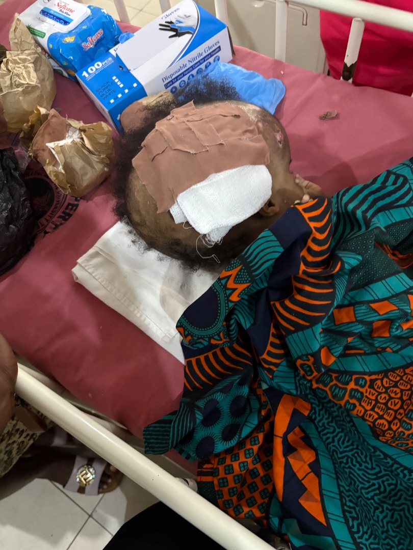 A cry for help: baby boy battling hydrocephalus